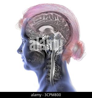 Immagine di una scansione a risonanza magnetica colorata (MRI) del cervello e del collo, che mostra l'anatomia del sistema nervoso centrale e la colonna cervicale. Foto Stock