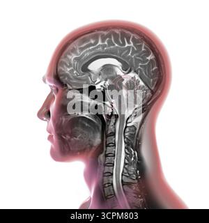 Immagine di una scansione a risonanza magnetica colorata (MRI) del cervello e del collo, che mostra l'anatomia del sistema nervoso centrale e la colonna cervicale. Foto Stock
