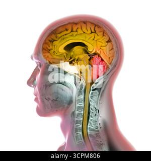 Immagine di una scansione a risonanza magnetica colorata (MRI) del cervello e del collo, che mostra l'anatomia del sistema nervoso centrale e la colonna cervicale. Foto Stock