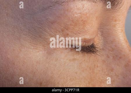 Vista laterale delle donne a occhio chiuso con rughe sulla palpebra Foto Stock