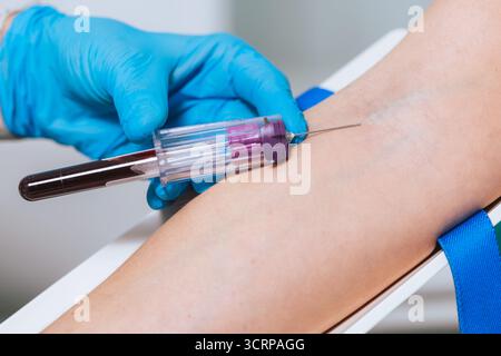 Persona che esegue il prelievo di sangue con guanti di sicurezza, pulisce la vena del braccio bersaglio con un tampone imbevuto di alcool. Concetto di sanità e medicina Foto Stock