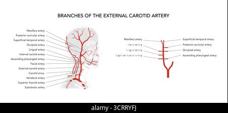 Set di diagramma medico delle arterie della testa umana sulla testa umana, diramazione del sistema carotideo esterno, vasi etichettati, illustrazione anatomica, riferimento didattico scientifico Illustrazione Vettoriale