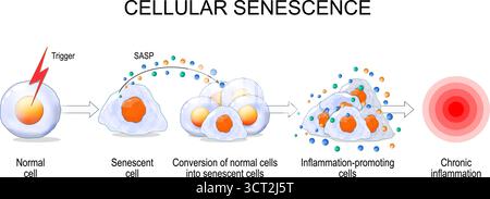 Senescenza cellulare. Processo di infiammazione cronica. Progredisce dai trigger iniziali, cellule senescenti, SASP, portando alla conversione delle cellule normali i Illustrazione Vettoriale