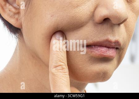 Pelle flaccida e rugosa sul viso di una donna anziana. Foto Stock