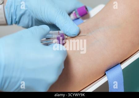 Persona che esegue il prelievo di sangue con guanti di sicurezza, pulisce la vena del braccio bersaglio con un tampone imbevuto di alcool. Concetto di sanità e medicina Foto Stock