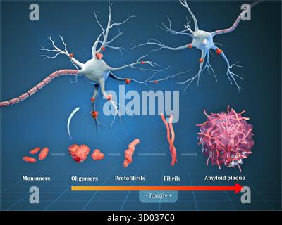 Diagramma che mostra diversi passi che portano alla formazione di placche amiloidi nella malattia di alzheimer. Illustrazione digitale, rendering 3D. Foto Stock