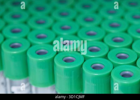 Preparazione per Plasmolifting. Provette per prelievo ematico in due strati divisi per centrifugazione dopo la manipolazione di personalizzazione. Foto Stock