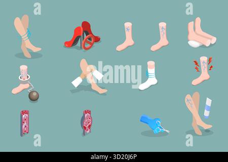 Set piatto isometrico 3D di trattamento varicoso, Health Care3D Isometric Flat Set di trattamento varicoso, assistenza sanitaria Foto Stock
