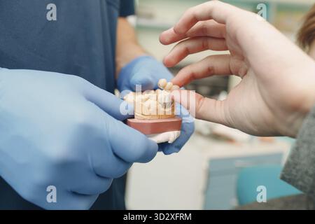 Odontoiatria. Il dentista mostra impianti al paziente. Clinica odontoiatrica Foto Stock