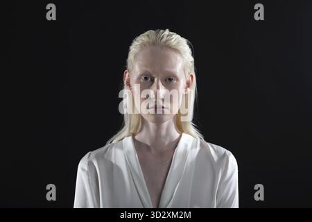 Primo piano ritratto di albino caucasico bionda donna Foto Stock