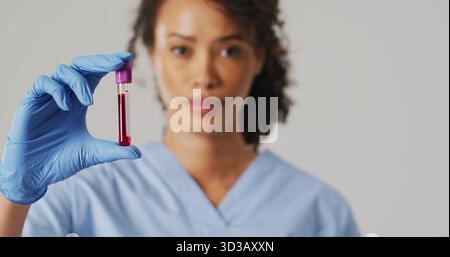 Tenere in mano un tecnico asiatico che indossa scrub blu e guanti che ispezionano la provetta per l'analisi del sangue in laboratorio Foto Stock