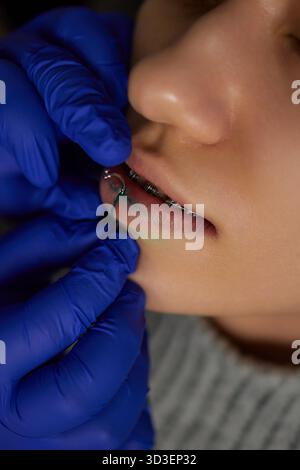 sorridi o frenulum che piergono sotto il labbro superiore. Foto Stock