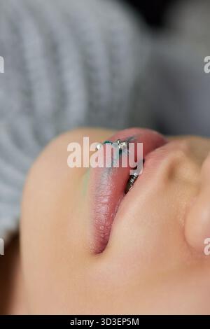 sorridi o frenulum che piergono sotto il labbro superiore. Foto Stock