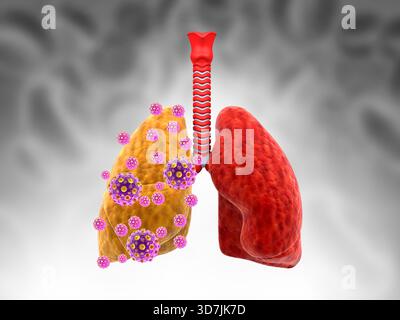 Polmoni umani con virus su sfondo medico. illustrazione 3d. Foto Stock