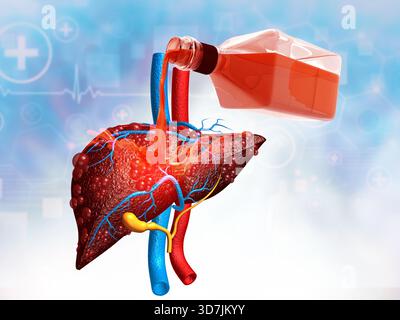 Alcol con fegato. Concavo di danno epatico alcolico. illustrazione 3d. Foto Stock