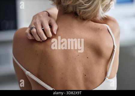 Donna caucasica di mezza età che si gratta alla schiena mentre frequenta il dermatologo Foto Stock