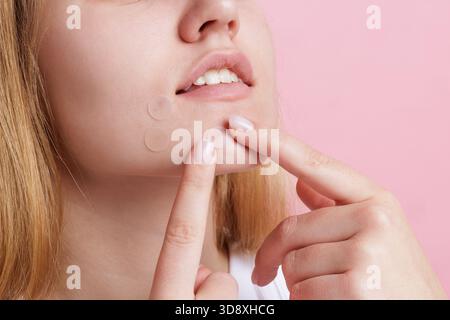 Faccia inferiore di una ragazza adolescente che tocca le macchie trasparenti sul mento e la guancia su sfondo rosa concetto di cura mirata dell'acne Foto Stock