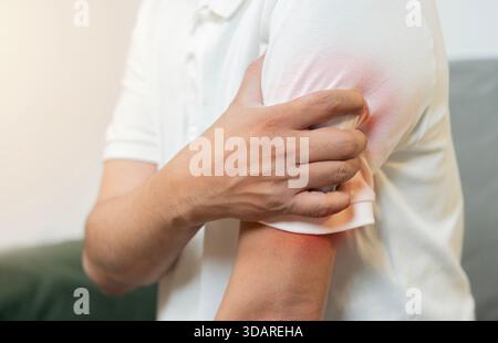 Primo piano di un uomo che soffre di dolore al braccio con infiammazione evidenziata, che simboleggia il disagio muscolare o articolare. Foto Stock