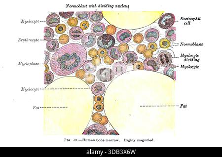 SEATTLE -SEP 18, 2023 - Vista altamente ingrandita del midollo osseo umano, che mostra varie cellule del sangue come eritrociti, mielociti, normoblasti e Foto Stock