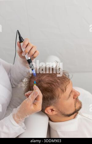 Alopecia. Perdita di capelli uomo migliorare la rigenerazione del trattamento di crescita, dermapen microneedling, vitamine esosomi iniezioni di plasma. Cosmetologo tricologo medico procedura cuoio capelluto mesoterapia frazionaria Foto Stock