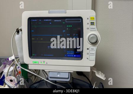 Un monitor medico mostra segni vitali quali la frequenza cardiaca e la pressione sanguigna. Il dispositivo si trova in una sala della struttura sanitaria, probabilmente utilizzata per la CA del paziente Foto Stock