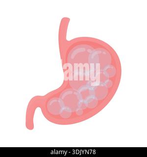 Stomaco umano con gonfiore. Illustrazione Vettoriale