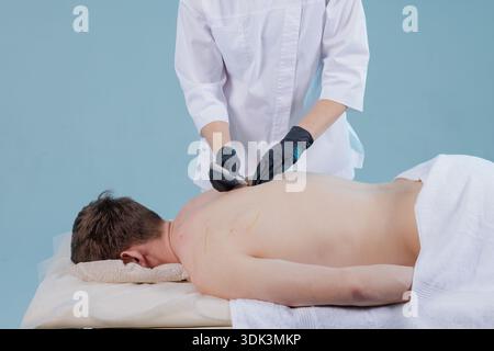 Primo piano di un fisioterapista che esegue un ago asciutto sulla schiena di un paziente di sesso maschile durante una sessione di trattamento in studio. Adatto per i siti Web di assistenza sanitaria, educ Foto Stock
