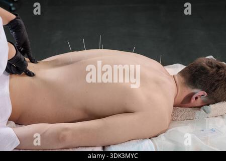 Primo piano di un paziente di sesso maschile che riceve agopuntura secca da aghi sulla schiena da un operatore sanitario. Adatto per siti web di cliniche, banner medici, Foto Stock