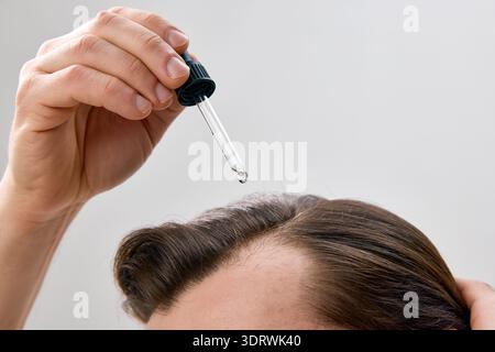 Primo piano della testa di mans con la mano che applica siero sui capelli con contagocce su sfondo grigio chiaro in un ambiente da studio pulito e minimalista Foto Stock