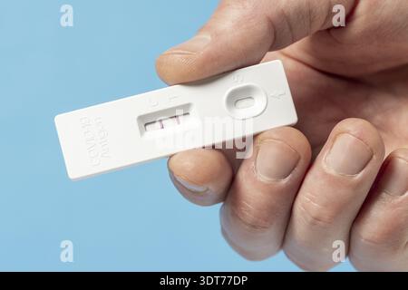 Mano che mostra il risultato positivo del test per Covid-19 con il kit per il test antigene rapido SARS CoV-2 (ATK). Concetto di protezione infettiva da coronavirus Foto Stock