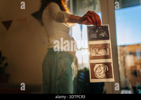 Donna incinta che tiene in braccio le ecografie, mostra lo sviluppo del bambino e si aspetta la maternità, celebra il viaggio di gravidanza e il futuro annuncio familiare || modello rilasciato Foto Stock