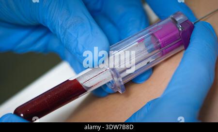 Un operatore sanitario sta prelevando sangue da un braccio di pazienti utilizzando un ago e una provetta di prova in una clinica medica. Foto Stock