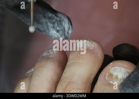 Un tecnico taglia le unghie dei piedi di un cliente con un attrezzo. Foto Stock