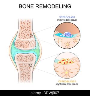 Rimodellamento osseo. Sezione trasversale del giunto. Primo piano di osteoblasti che sintetizzano il tessuto osseo e l'osteoclasto rimuove il tessuto osseo. Illustrazione vettoriale. Illustrazione Vettoriale