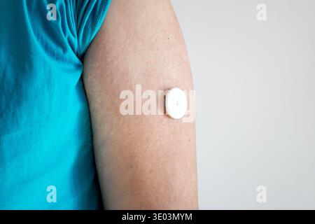 Un uomo affetto da diabete mellito controlla il livello di glucosio nel sangue a casa utilizzando un glucometro continuo. Un tizio in sovrappeso controlla i suoi livelli di glucosio Foto Stock
