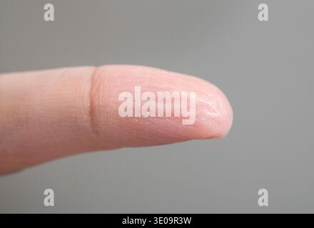 Pelle rugosa di un dito della mano a causa del lungo periodo di tempo in acqua. Foto Stock