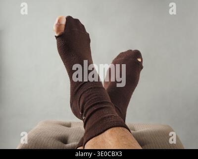 Un paio di piedi con calzini marroni con un foro nella punta grande Foto Stock