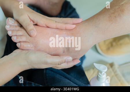 Piede, dolore e vecchia donna ferita. Mani di infermiere che applicano crema ai piedi di una donna anziana a casa. Primo piano, messa a fuoco selettiva. Foto Stock