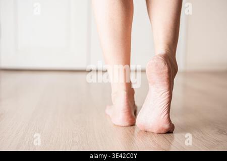 Pelle asciutta dei piedi della donna, suola con scaglie e crepe. Gambe femminili, piedi con pelle asciutta sui tacchi. Concetto di assistenza sanitaria, cura del corpo e podologia. Foto Stock