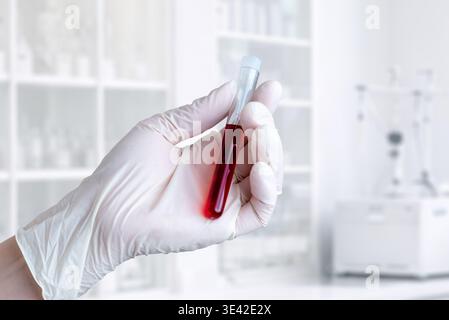 Primo piano di una provetta per test con guanti e liquido rosso, analisi di laboratorio su sfondo clinico luminoso Foto Stock