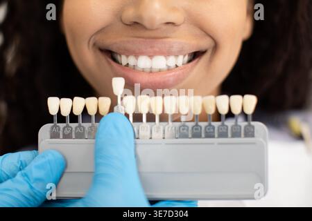 Dentista maschio di colore nero che indossa i guanti che tengono la guida dell'ombreggiatura dentale scelta del colore dei denti per la paziente di sesso femminile in clinica Foto Stock
