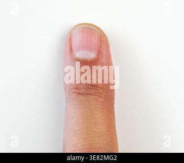 primo piano di un dettaglio estremo di un dito maschile Foto Stock