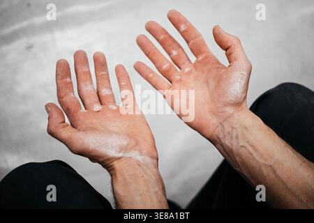 Mani maschili ricoperte di gesso dopo il percorso duro: Primo piano di dita usurate e pelle rivestita con nastro adesivo. Foto di alta qualità Foto Stock
