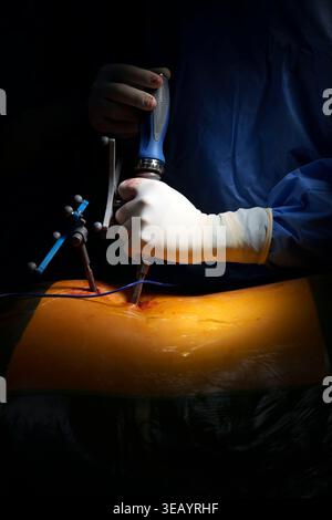 Chirurgo che esegue un intervento chirurgico spinale di precisione utilizzando strumenti di tracciamento della navigazione in sala operatoria Foto Stock