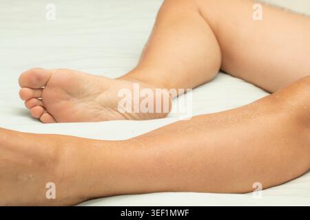 Gambe e piedi umani che mostrano la consistenza secca della pelle e i calli su uno sfondo chiaro Foto Stock