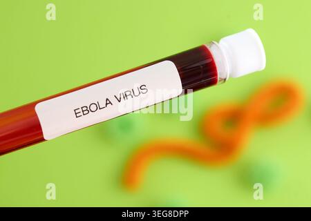 Campione di sangue da virus Ebola in provetta per test di laboratorio Foto Stock