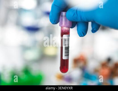 Mano con guanti, contenente una provetta per analisi con sangue e etichetta con codice a barre in un ambiente di laboratorio Foto Stock