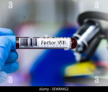 Provetta per campione di sangue per analisi del fattore VIII. Foto Stock