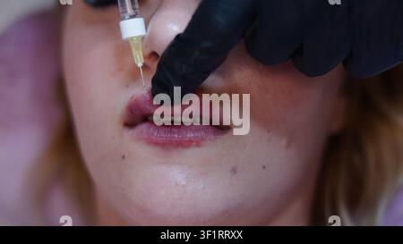 Donna che si sottopone a un'iniezione di filler per le labbra per l'estetica del viso Foto Stock