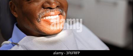 Paziente anziano nero sorridente che mostra denti bianchi sani dopo il trattamento dentale Foto Stock
